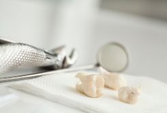 Больной зуб: сохранить или удалить?